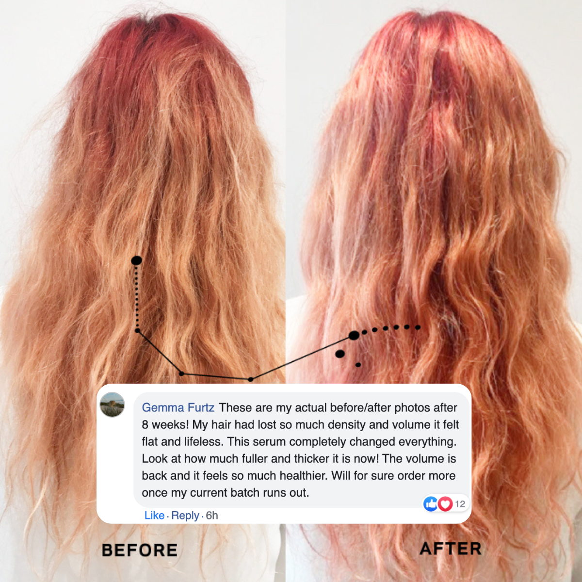 Revive Hair Growth Oil For GLP-1 Hair Loss