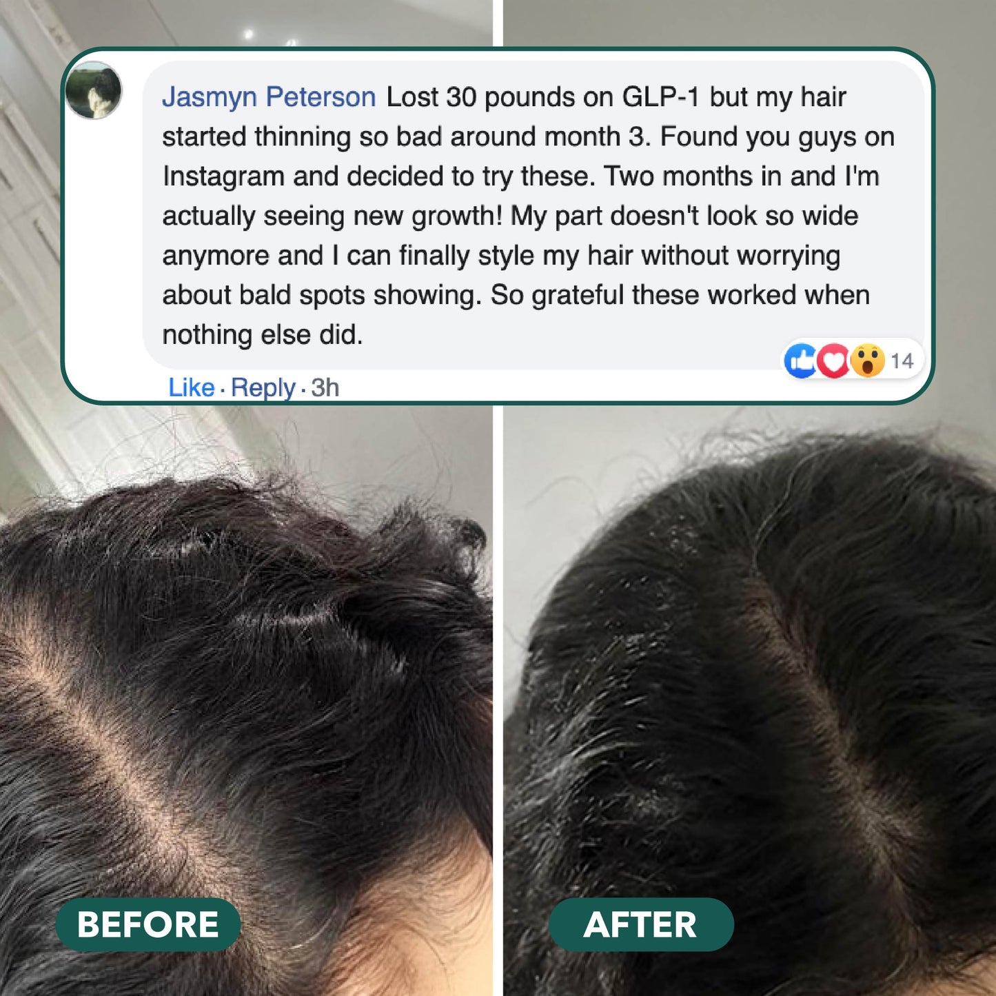 Hair Revive Capsules